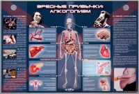 Электрифицированный стенд "Вредные привычки: алкоголизм" - «globural.ru» - Саранск