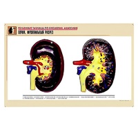 Рельефная таблица "Почка. Фронтальный разрез" (формат А1, матовое ламинир.) - «globural.ru» - Саранск