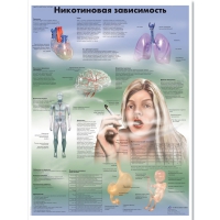 Плакат "Никотиновая зависимость", ламинированный, 50*67 см - «globural.ru» - Саранск